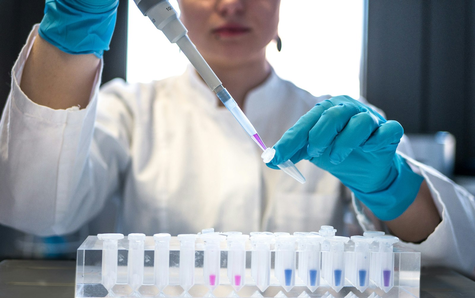 Wissenschaftlerin arbeitet mit Pipette und Reagenzgläsern im Labor